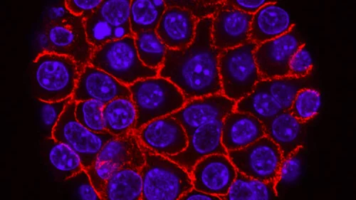 national-cancer-institute-u17jq-hpwuy-unsplash-1000x1000