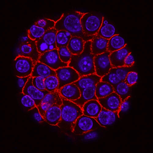 national-cancer-institute-u17jq-hpwuy-unsplash-1000x1000